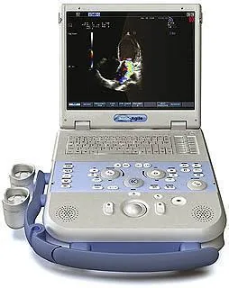 KONTRON Imagic Agile ultrasound machine