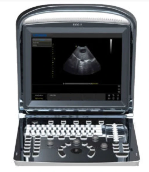 MEDGYN Eco 3 ultrasound machine