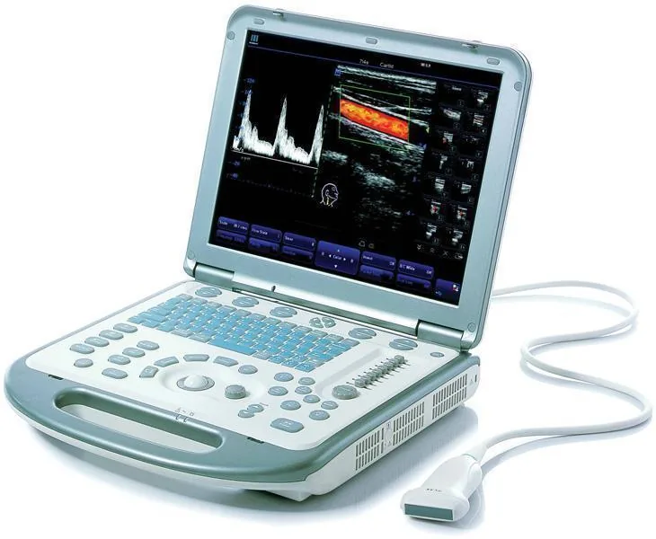 MINDRAY M5 ultrasound machine