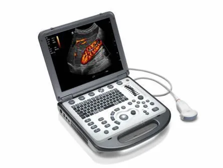 MINDRAY M6 ultrasound machine