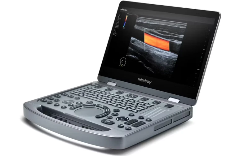 MINDRAY MX3 ultrasound machine