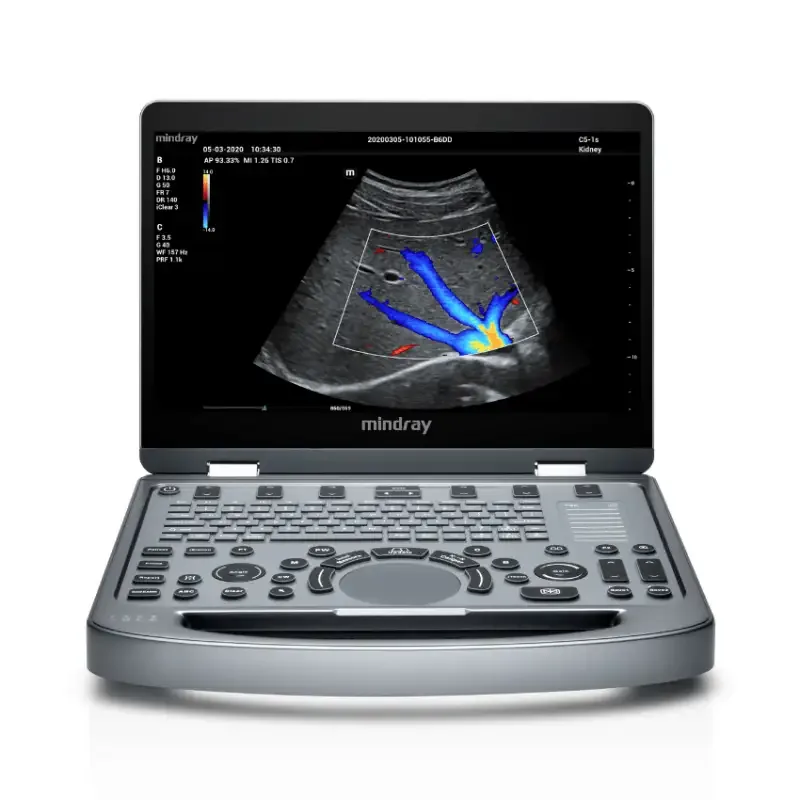 MINDRAY MX5 ultrasound machine