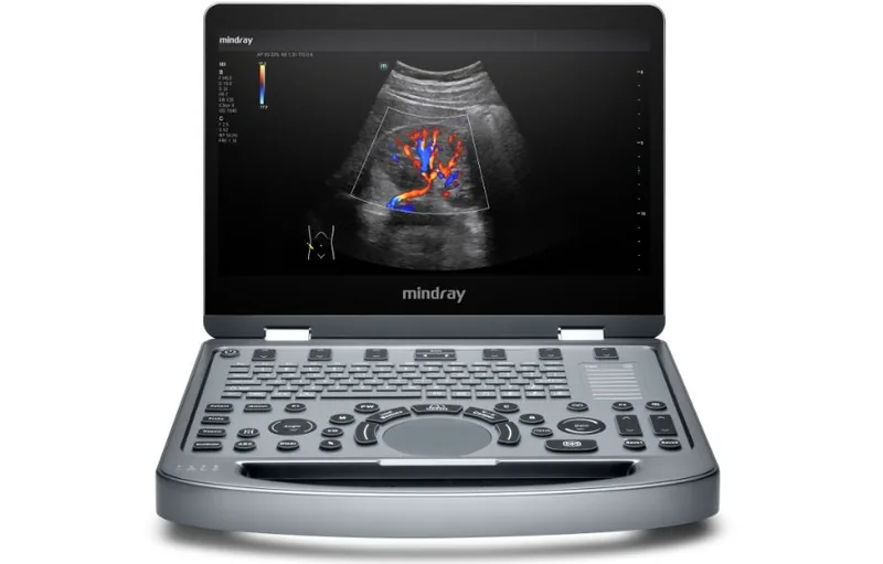 MINDRAY MX6 ultrasound machine
