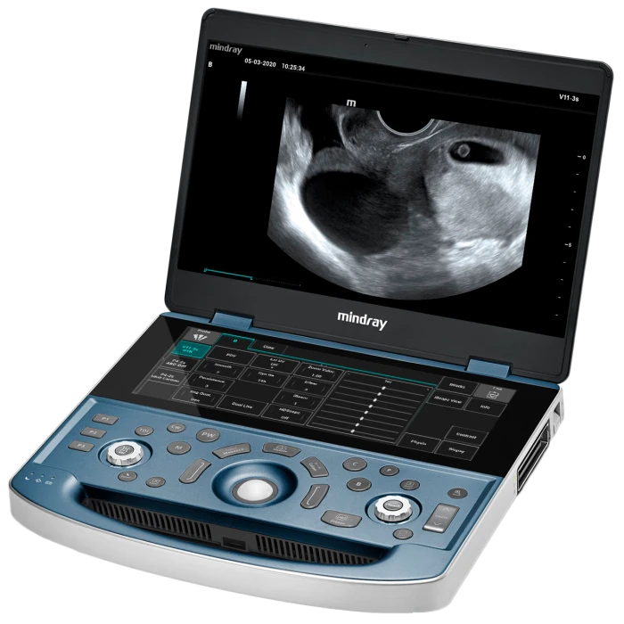 MINDRAY MX8 ultrasound machine