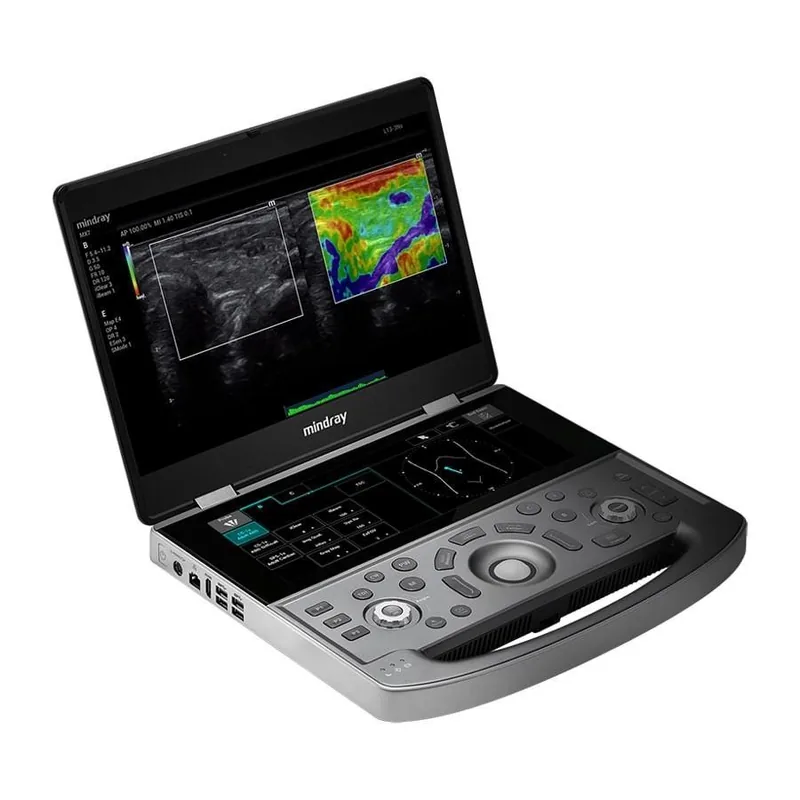 MINDRAY MX8 Exp ultrasound machine
