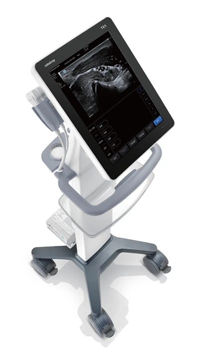 MINDRAY TE5 ultrasound machine