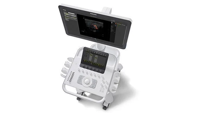 PHILIPS 3300 ultrasound machine