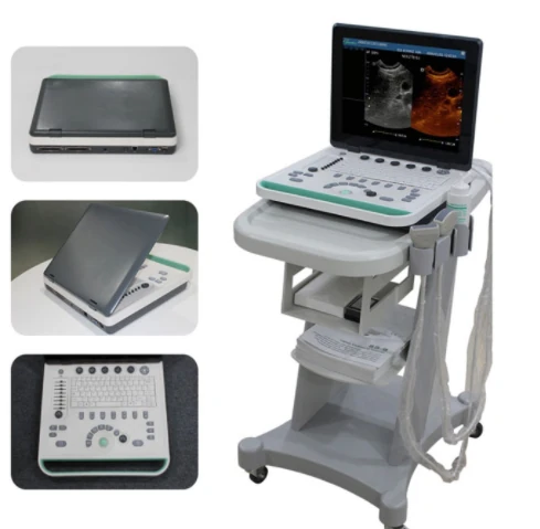 QZ QZ-S2 ultrasound machine
