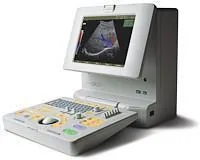 SAMSUNG SonoAce Pico ultrasound machine