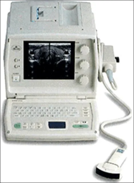 SAMSUNG SonoAce SA-600 ultrasound machine