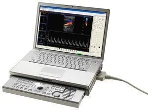SIEMENS P50 ultrasound machine