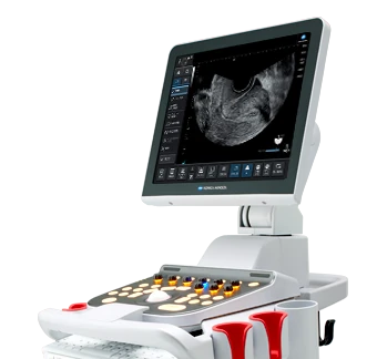 SIEMENS Sonovista GX30 ultrasound machine