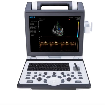SIUI Apogee 1100 ultrasound machine