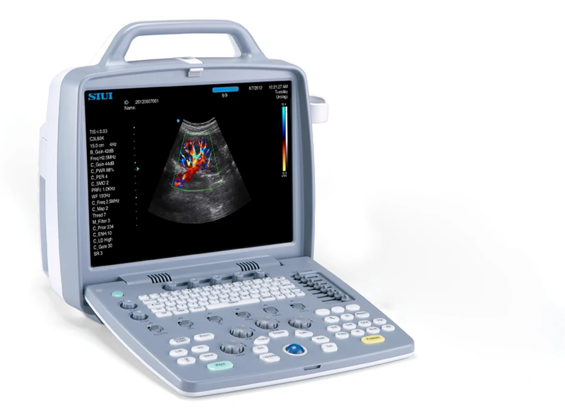 SIUI Apogee 1100 Touch ultrasound machine