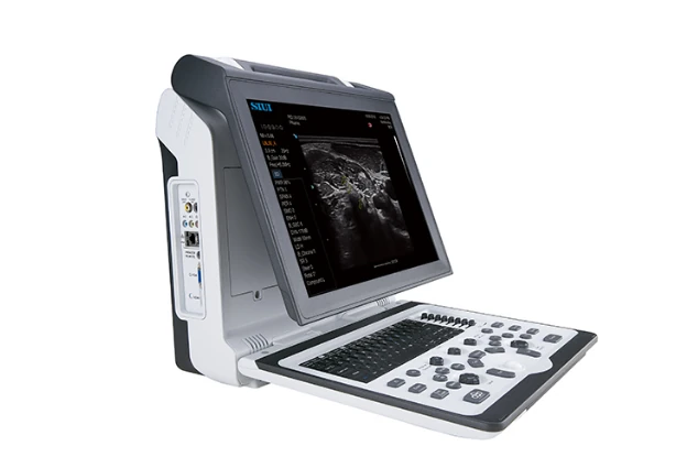 SIUI Apogee 2300 ultrasound machine