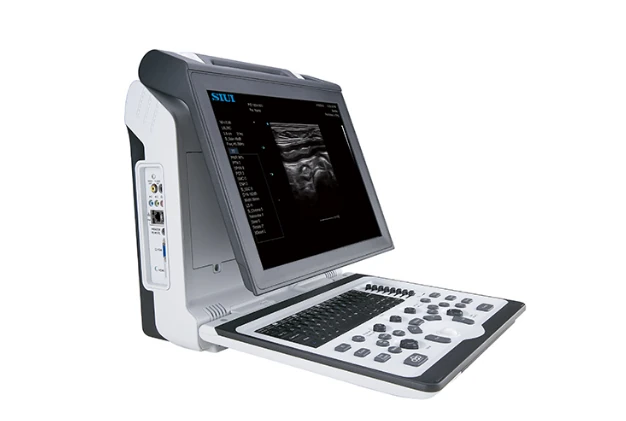 SIUI Apogee 2300V ultrasound machine
