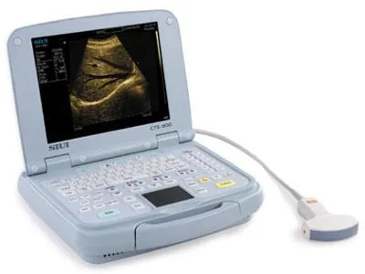SIUI CTS-900 ultrasound machine