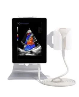 SONOSCANNER U-Lite EXP ultrasound machine