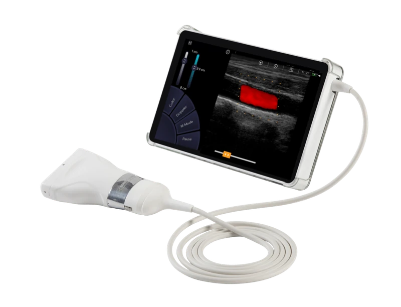 SONOSCANNER U-Lite PRO ultrasound machine