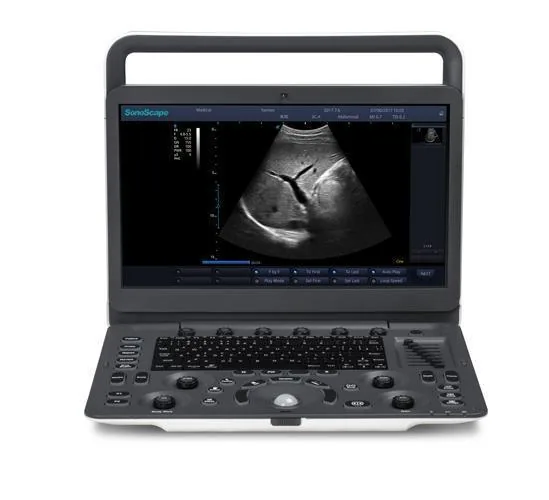 SONOSCAPE E1 ultrasound machine