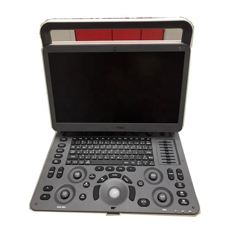 SONOSCAPE E2V ultrasound machine