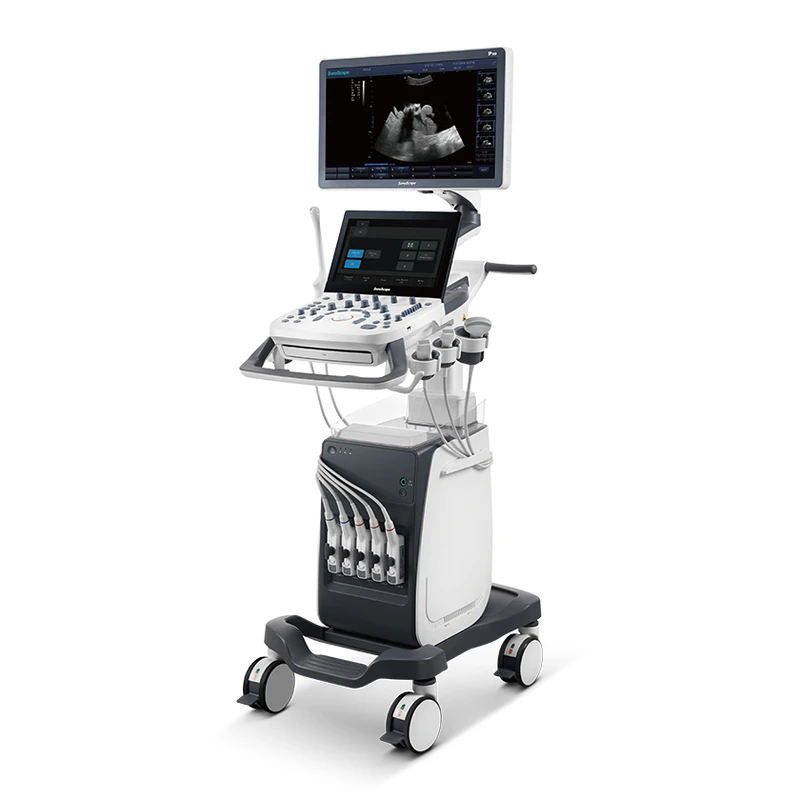 SONOSCAPE P10 ultrasound machine