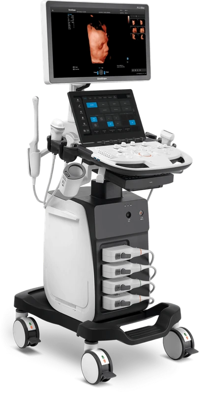 SONOSCAPE P11 Elite ultrasound machine