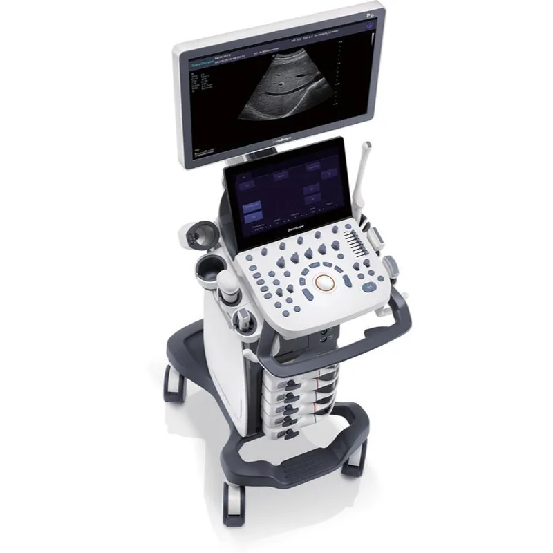 SONOSCAPE P15 ultrasound machine