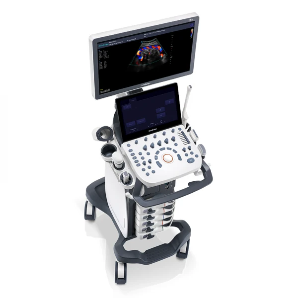 SONOSCAPE P15V ultrasound machine