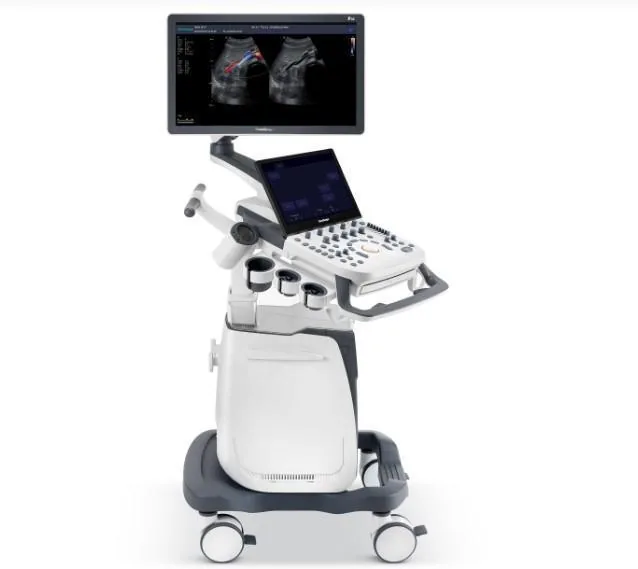 SONOSCAPE P25 ultrasound machine