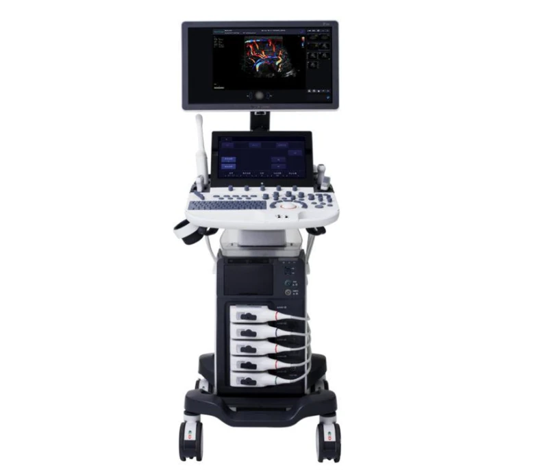 SONOSCAPE P50 ELITE ultrasound machine