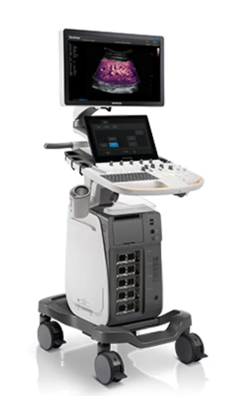 SONOSCAPE P60 ultrasound machine