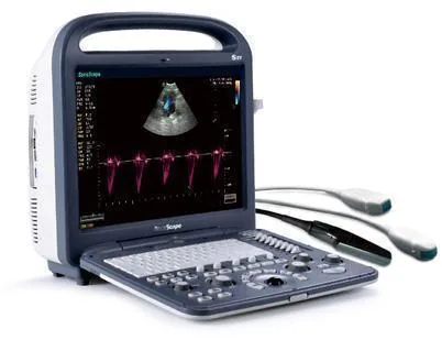 SONOSCAPE S2V ultrasound machine