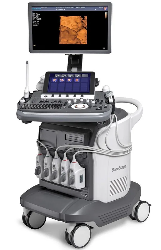 SONOSCAPE S40 Exp ultrasound machine