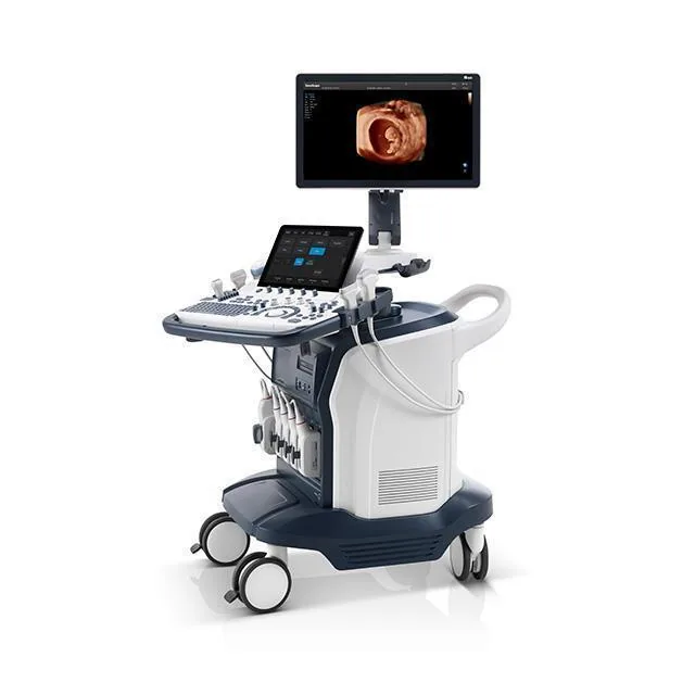 SONOSCAPE S60 ultrasound machine