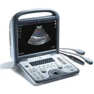 SONOSCAPE S6V ultrasound machine