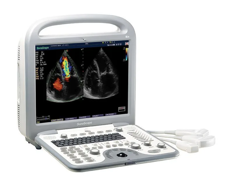 SONOSCAPE S8 ultrasound machine