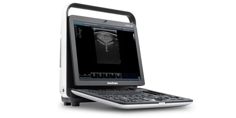 SONOSCAPE S8 ExpV ultrasound machine