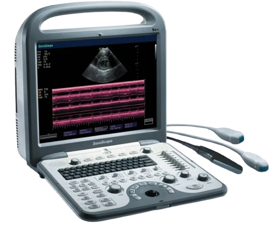 SONOSCAPE S8V ultrasound machine