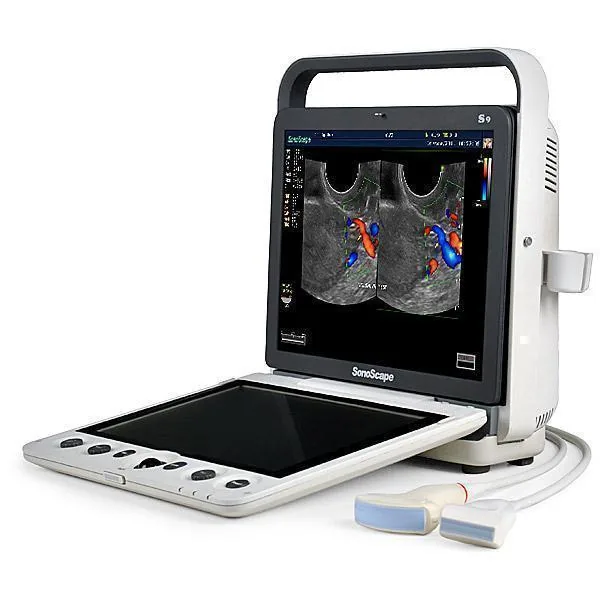 SONOSCAPE S9 ultrasound machine
