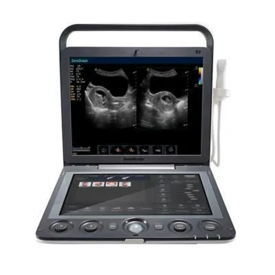 SONOSCAPE S9V ultrasound machine