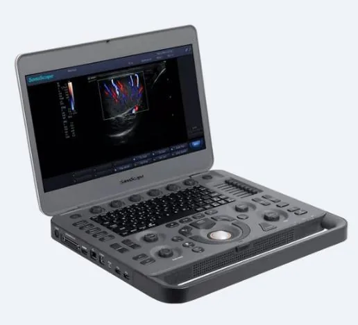 SONOSCAPE X1 ultrasound machine
