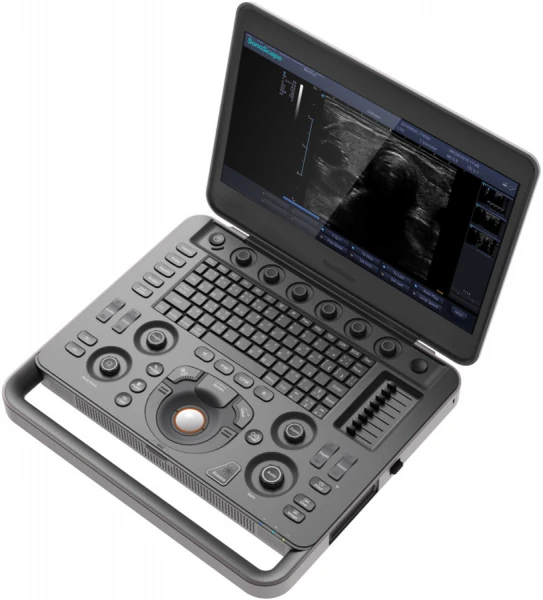 SONOSCAPE X3 Exp ultrasound machine