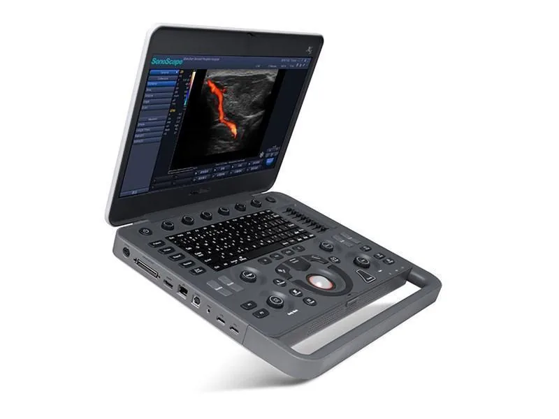 SONOSCAPE X5V ultrasound machine