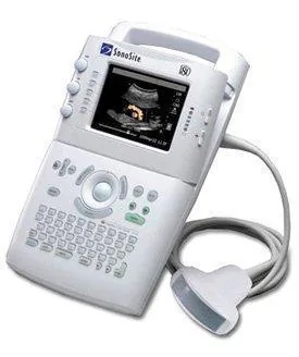 SONOSITE 180 PLUS ultrasound machine
