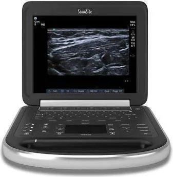 SONOSITE Edge ultrasound machine