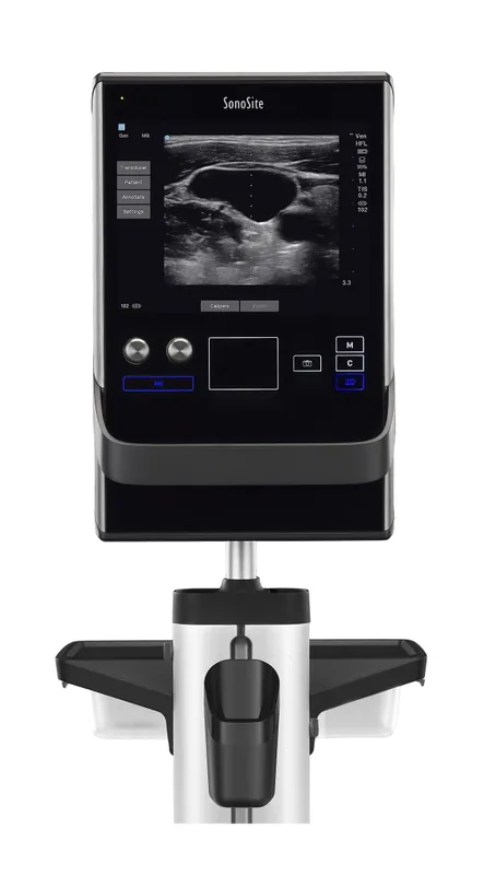 SONOSITE SII ultrasound machine