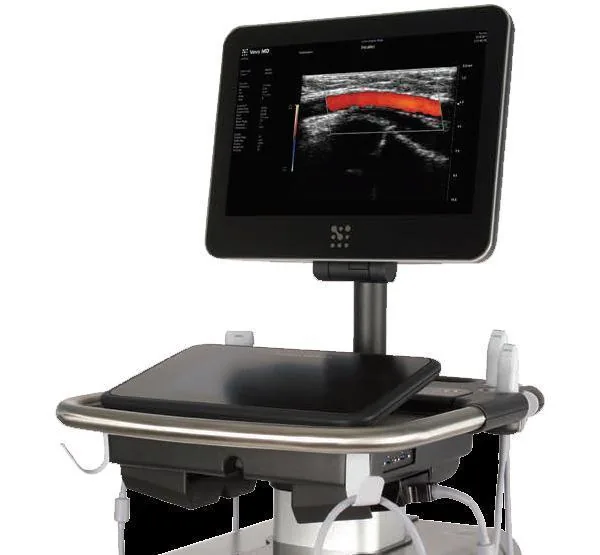 SONOSITE VEVO MD ultrasound machine
