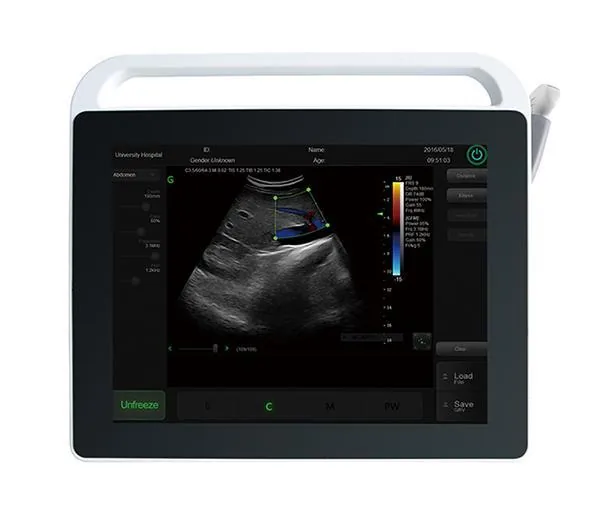 SONOSTAR C3 ultrasound machine