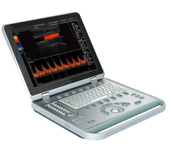 SONOSTAR C5 ultrasound machine